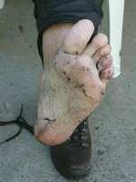Auflsung der Socken