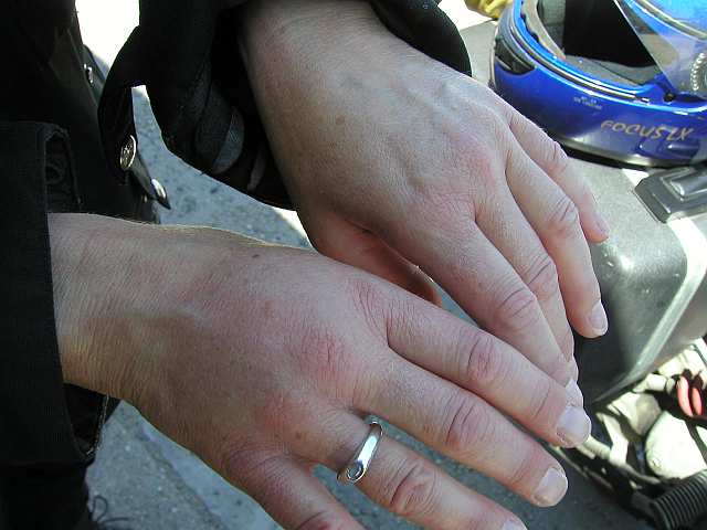 ein Stich und seine Wirkung